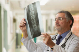 orthopedic specialist looking at x-rays