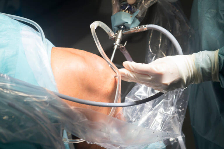 orthopedic surgeons operating Arthroscopy surgery